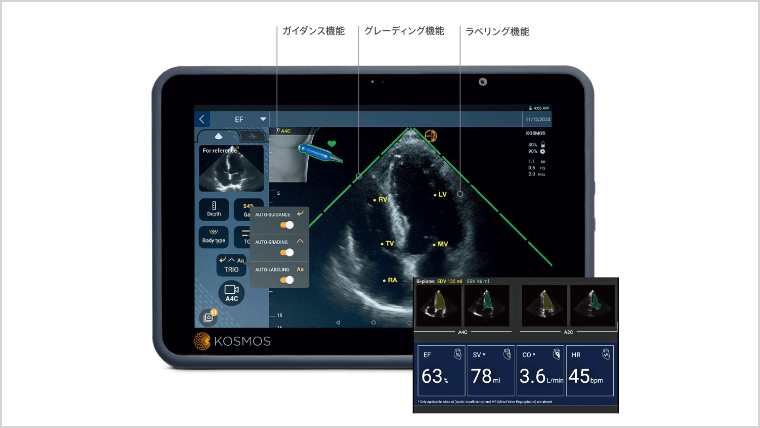 Auto EF計測が可能