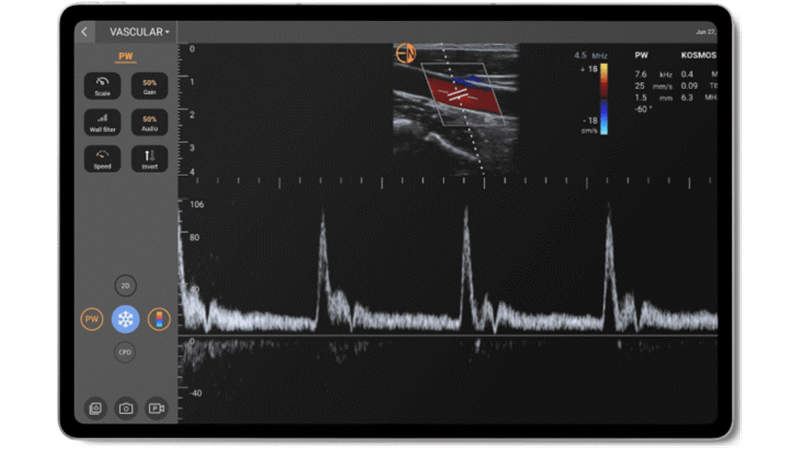 KOSMOS Series | カーディナルヘルス医療関係者向け製品情報サイト