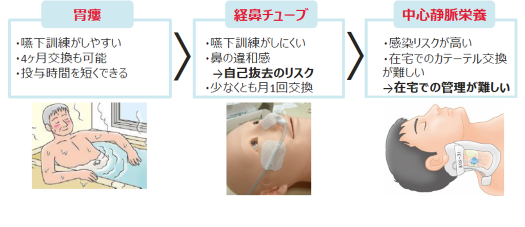 栄養管理の選択（胃ろう・経鼻チューブ・中心静脈栄養）