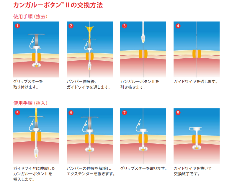 KBⅡの交換方法