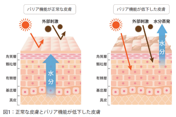 Technical Report見えないものを見る_図1正常な皮膚とバリア機能が低下した皮膚