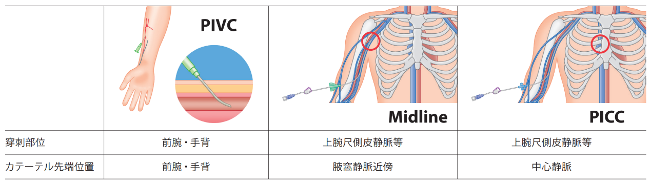 PIVC_Midline_PICC比較