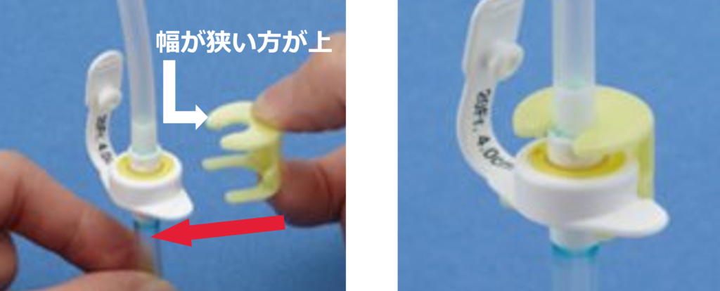 カンガルーボタンⅡの投与セットに付いている黄色い部品は何です